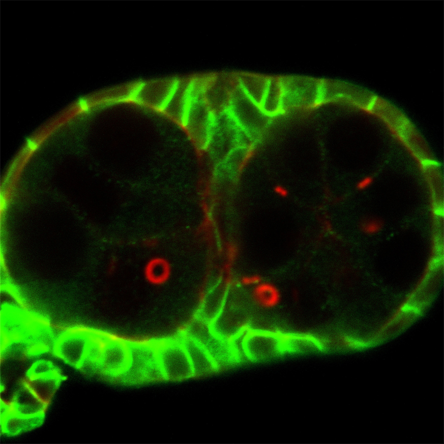 http://www.ige.tohoku.ac.jp/prg/genetics/study_report/upload_items/201504/1B1_fic_05_x63x27_gain800.jpg